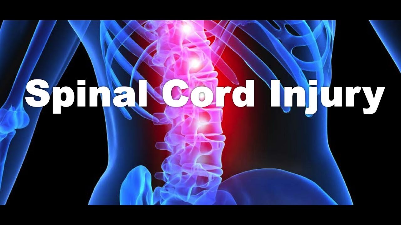 Causes And Prevention Of Spinal Cord Injuries